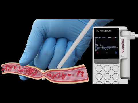 Arjo Announces New Single-Use Intraoperative Doppler System