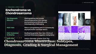 Chondrosarcoma Masterclass: Subtypes, Diagnosis, Grading & Surgical Management