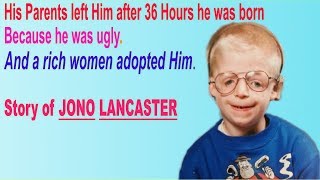 Love me love my face Motivational Story of JONO LANCASTER