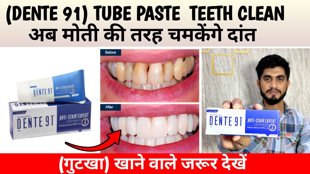 तीन दिन में दांत चमकेंगे मोती की तरह ॥ Dente91 AntiStain Expert