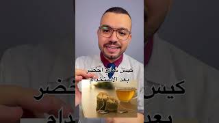 حخليكي تخفي الهالات السوداء تحت العين ?