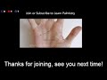 Join Palmistry Q and A Live Chat