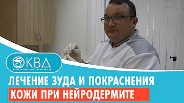 ➡ Лечение зуда и покраснения кожи при нейродермите. Клинический случай №986
