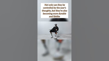The Future of Prosthetics: Bionic Limbs That Are Changing Lives