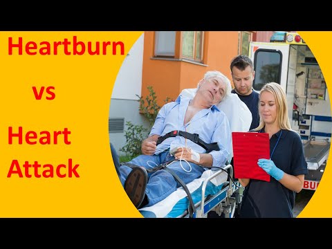 Heartburn vs Heart Attack