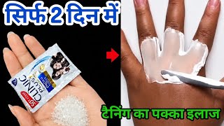 शैंपू में सिर्फ एक चीज मिलते ही आपकी जिद्दी सारी ट्रेनिंग एक बार में जड़ से खत्म हो जाएगी हमेशा.....