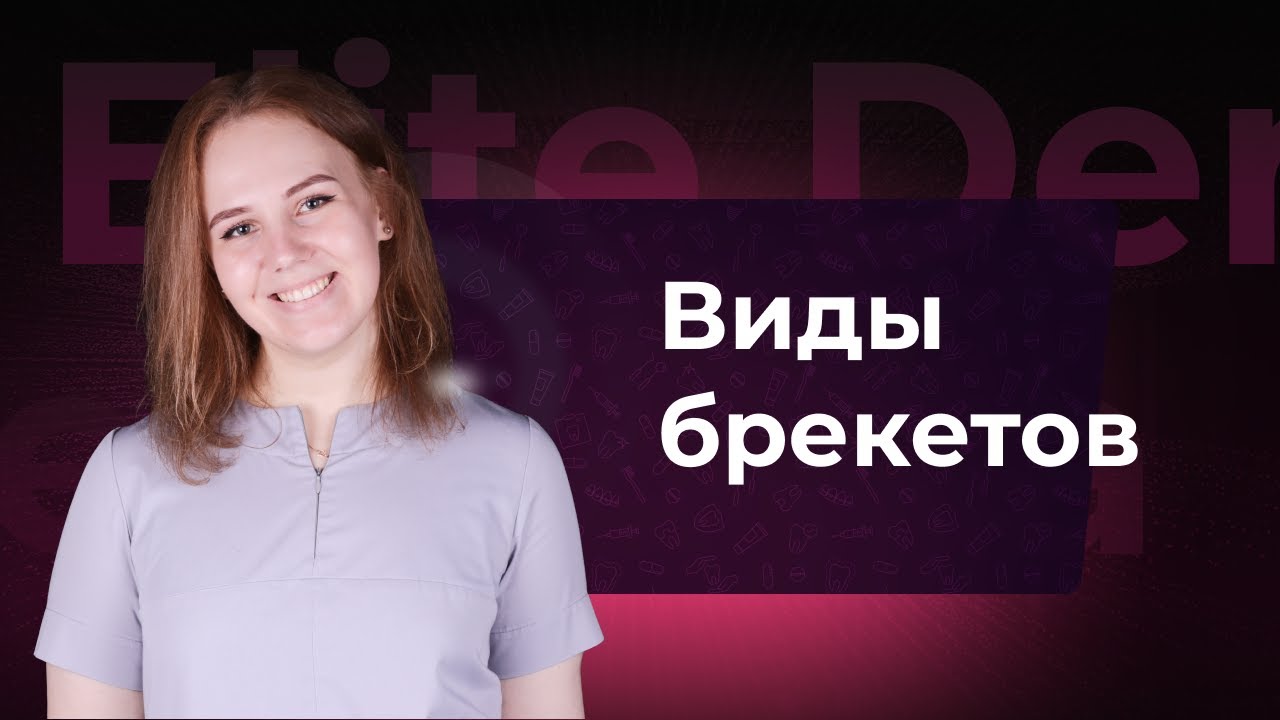 Виды брекетов: лигатурные, самолигирующие и элайнеры. Сколь это стоит ...