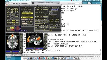 Resting-State Analysis, Part V: Create Correlation Maps