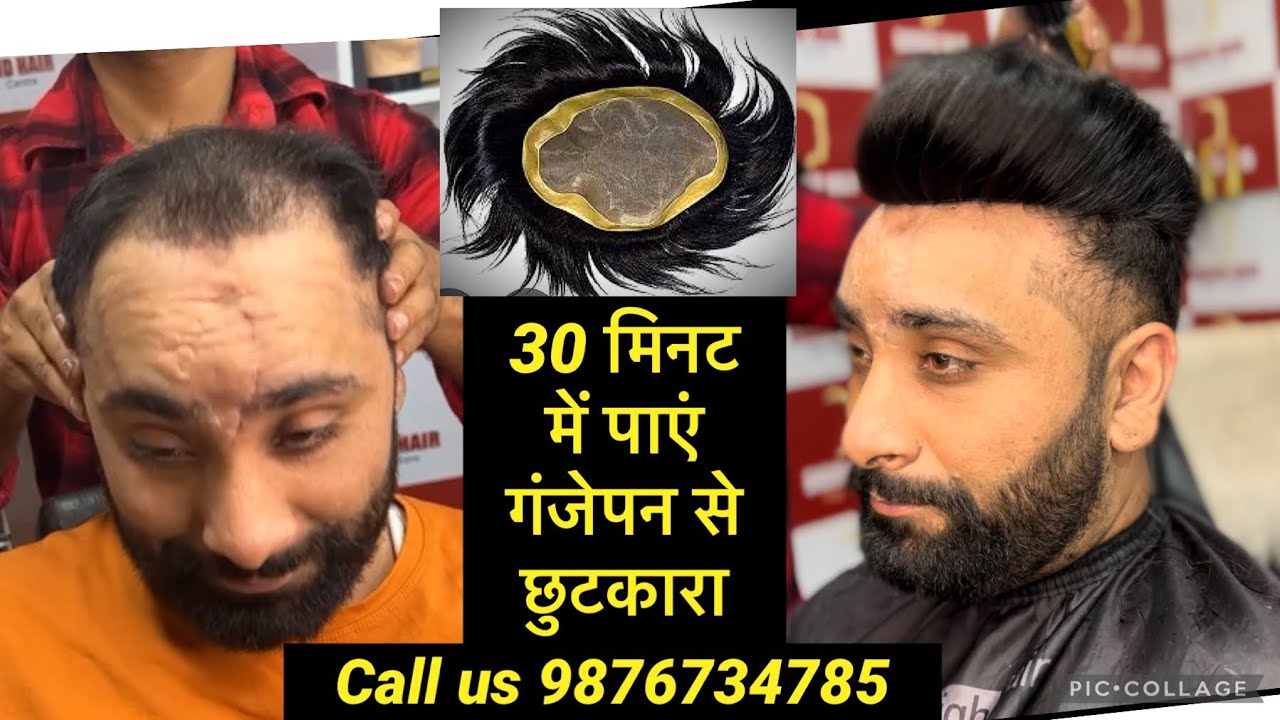 Best Hair Patch in Jalandhar 2022 Number 1 Quality New Trending