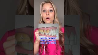 Common Braces Rubber Band Patterns Explained By An Orthodontist How Bands Fix Your Bite