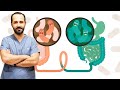 Hangi Hastalıklarda Gaita Nakli'ne İhtiyaç Vardır? - Doç. Dr. Hakan Demirci