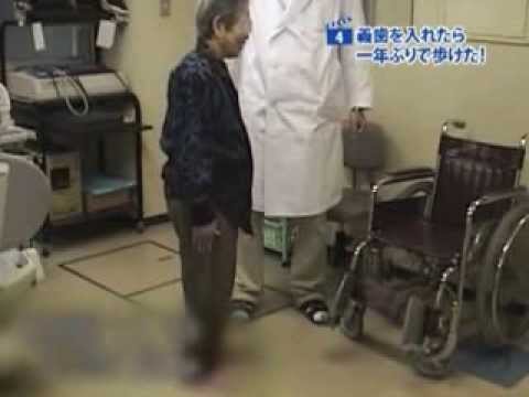 症例4  義歯を入れたら１年ぶりに歩けた