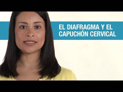 ¿Qué es el diafragma y el capuchón cervical?
