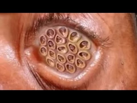 驚愕 化粧を落とさないだけでこんなことになるとは Youtube 驚愕 化粧を落とさないだけでこんなことになるとは Youtube