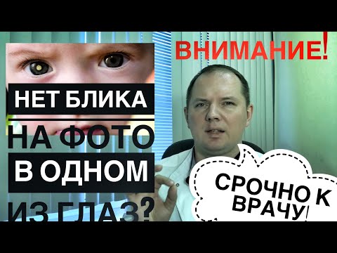 ВНИМАНИЕ! НЕТ БЛИКА В ГЛАЗАХ НА ФОТО - СРОЧНО К ВРАЧУ!