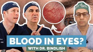 Why Is Your Eye Bloody  Might Be A Hyphema Doctors Break It Down