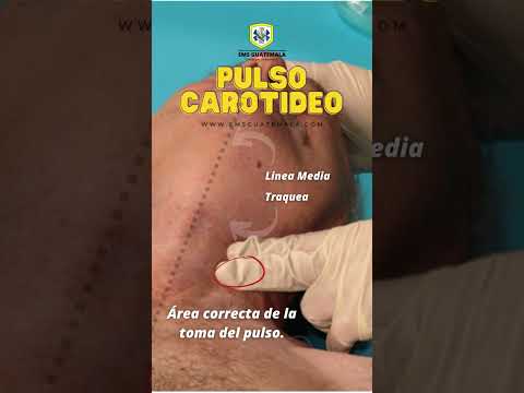 Video: ¿Dónde se encuentra el pulso carotídeo?