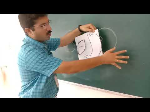 Development of Peritoneum