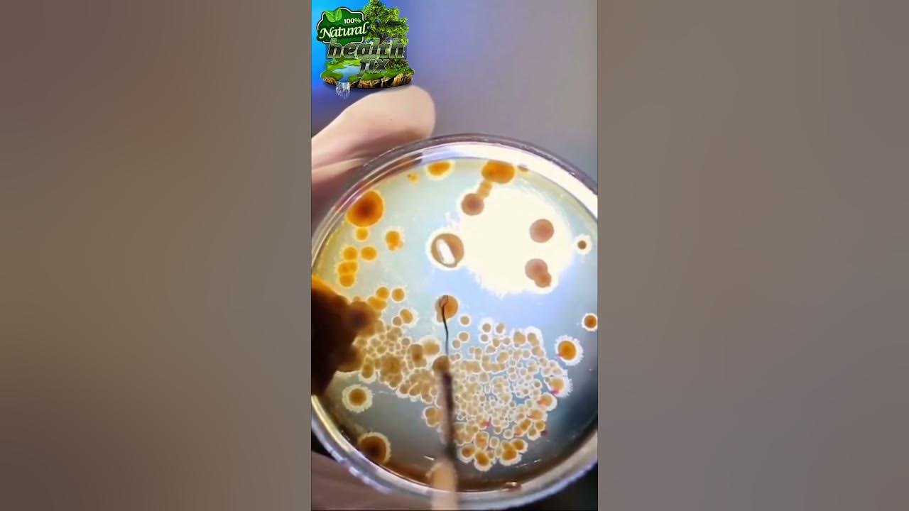 GERD Acid Reflux CURE with Apple Cider Vinegar shorts health YouTube