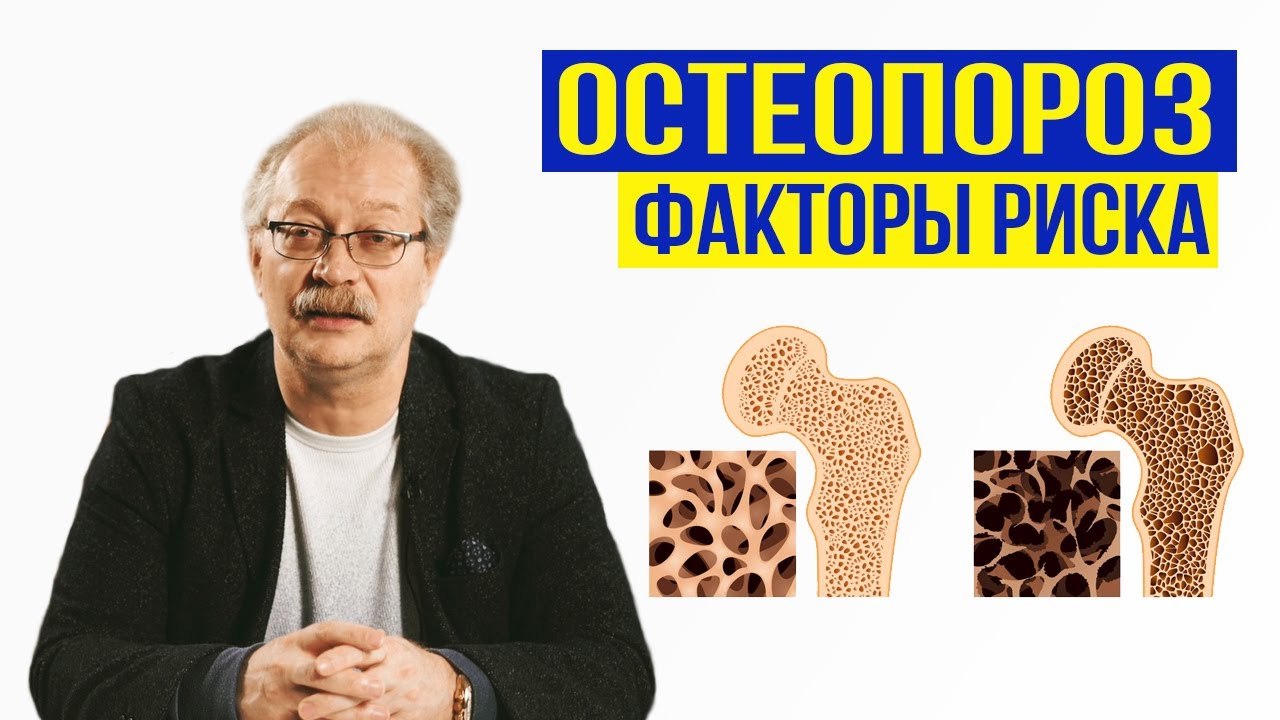 Остеопороз. Факторы риска. Поможет ли кальций? Андрей Продеус