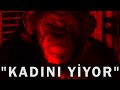 Etkisinden Halen Çıkamadığım Korkunç Şempanze Saldırısı