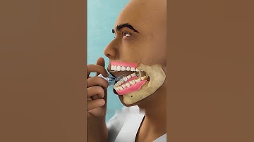 How A Light Bulb Can Trap Your Jaw 😱#shorts