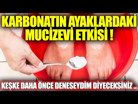 Karbonatın Ayaklara İnanılmaz Etkisi ! Keşke Daha Önce Deneseydim Diyeceksiniz !