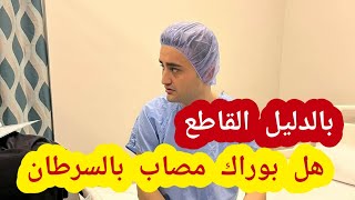 ما حقيقة مرض شيف بوراك وهل فعلا الشيف بوراك مصاب بمرض السرطان