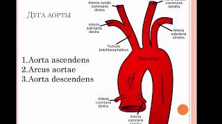 Coarctation of the Aorta. Коарктація Аорти.Ukrainian swarm.