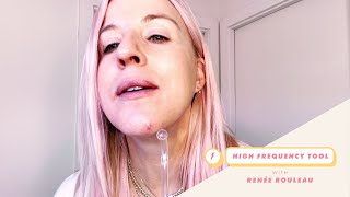 Learn How to Get Rid of Acne FAST Using High Frequency | Celebrity Esthetician Renée Rouleau