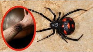 ⚠️ Lo Que la Araña Más Peligrosa del Mundo Puede Hacer Te Sorprenderá | Documental Impactante