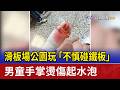滑板場公園玩「不慎碰鐵板」 男童手掌燙傷起水泡