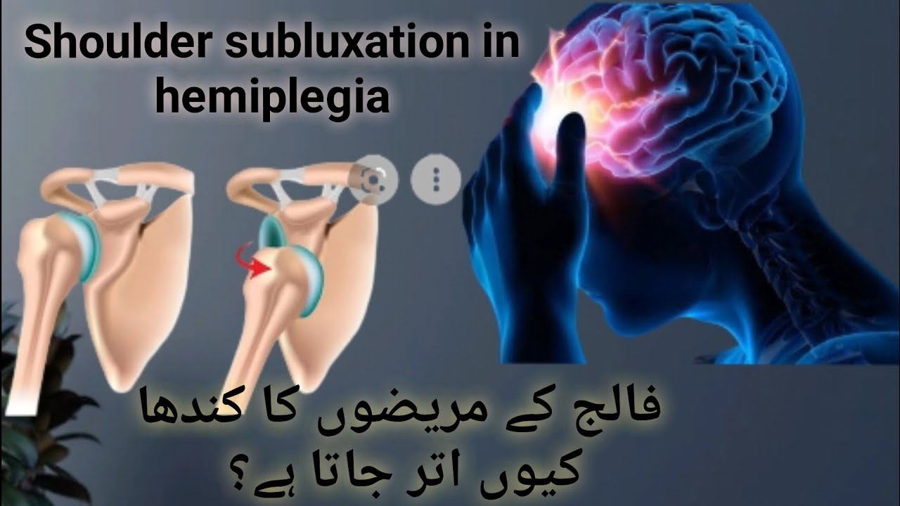 shoulder subluxation in stroke patients/ shoulder pain after stroke