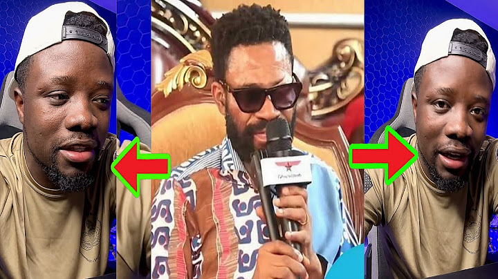"Ɛyɛ Contract? Kofi Adomah’s Eye Incident Exposed – Unbelievable Twist Shakes Ghana!"