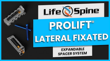 ProLift Lateral Fixated Expandable Spacer System