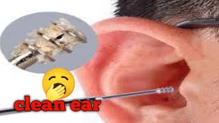 clean ear