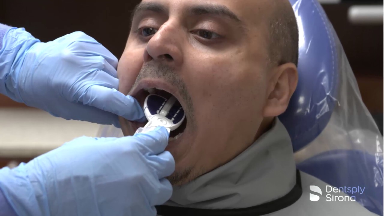 RINN SnapARay DS Posterior Placement Dentsply Sirona YouTube