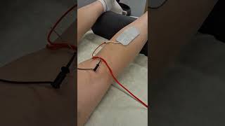 NMP - Neuromodulatie Percutaan behandeling fysiotherapie