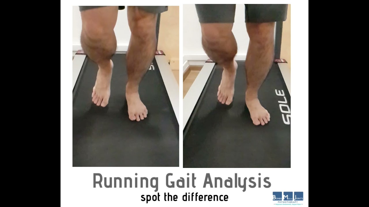 gait analysis case study