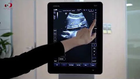 Mindray's Smart IVC Training and Demonstration