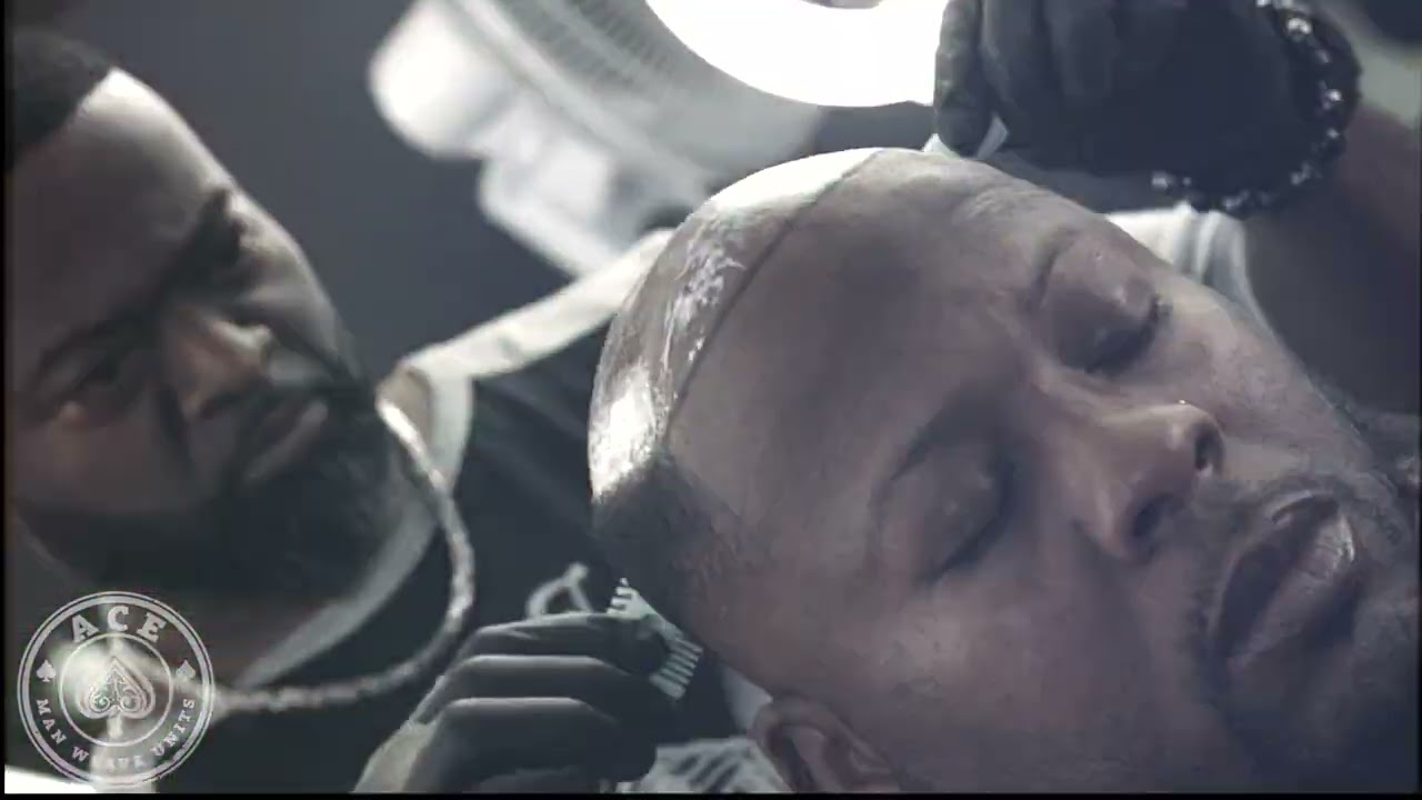 Man Weave Dallas | Hair Replacement Dallas, Texas