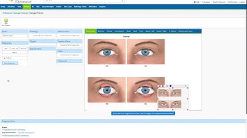 CREATING Protocols for 1 Minute Exam coding in Eyefinity EHR