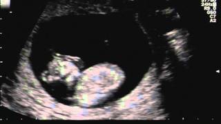 16 Sedicesima Settimana Di Gravidanza Pianetamamma It