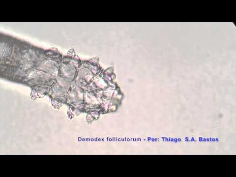 Demodex folliculorum (hominis) ♀