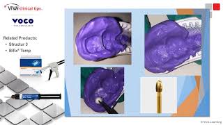 Dr. Lipscomb on Structur 3 and Bifix Temp