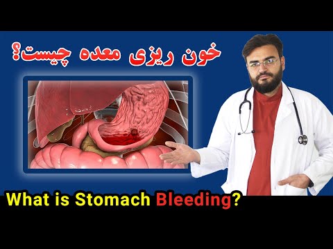 دلیل خون ریزی معده چیست چرا از معده خون می آید داکترستان What Is Stomach Bleeding Causes 