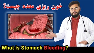 دلیل خون ریزی معده چیست؟ | چرا از معده خون می آید؟ | داکترستان ❤ What is Stomach Bleeding Causes