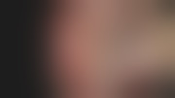 Cecal/AO LST-G EMR/FTRD