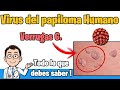 VIRUS del PAPILOMA HUMANO verrugas  Sintomas, TRATAMIENTO y PREVENCION VPH | HPV