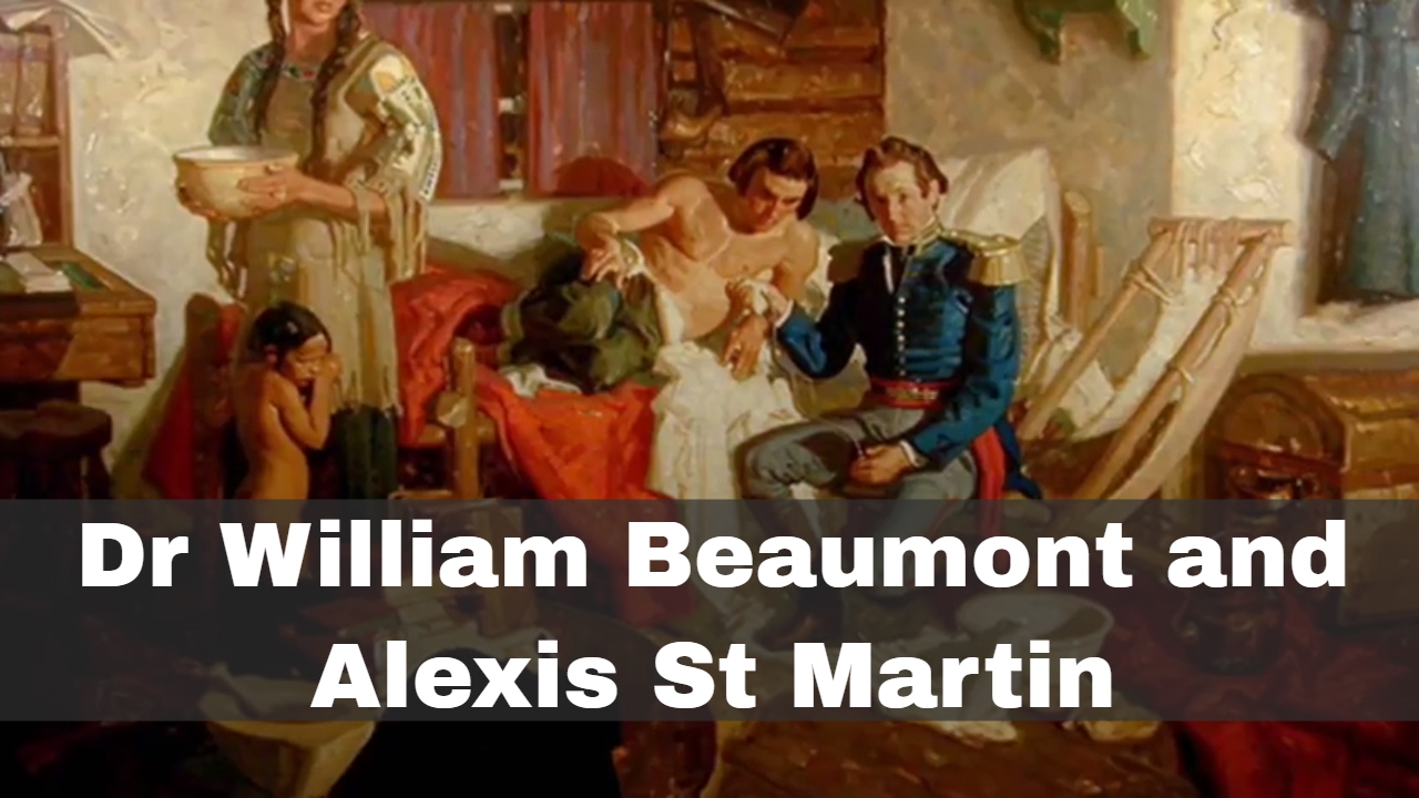 6th June 1822: William Beaumont first treats Alexis St Martin - YouTube